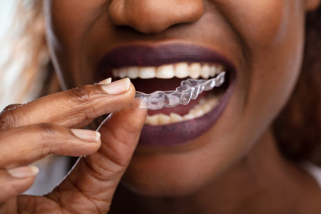 Invisalign treatment in Hartland, Michigan