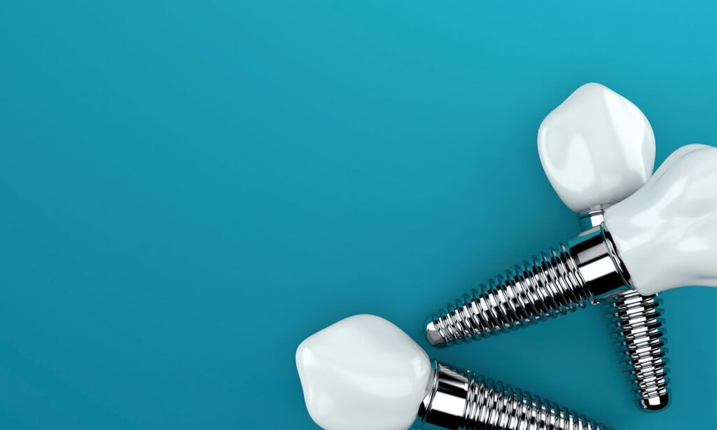 types of dental implants in Hartland Michigan