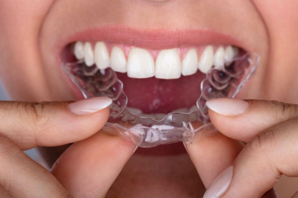 invisalign teeth straightening treatment Hartland Michigan